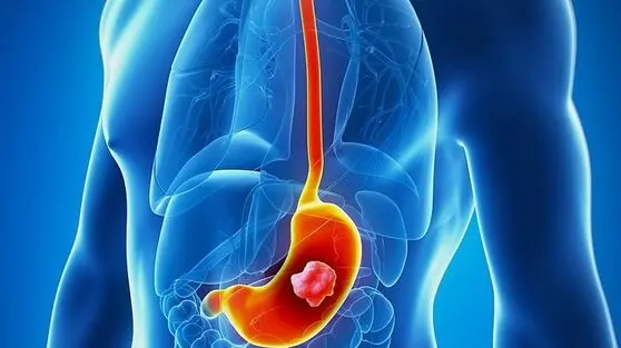 فاجعه زمستانی در کمین است: چگونه در دام نوروویروس سمی قرار نگیریم