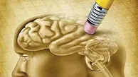 ۵ راهکار ساده برای داشتن مغز سالم و حافظه‌ای قوی؛ چگونه از زوال عقل جلوگیری کنیم؟
