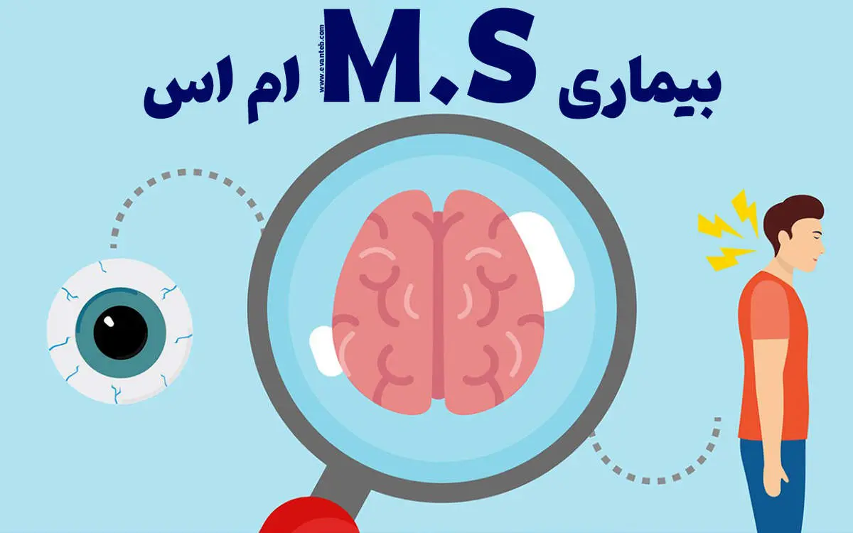 ام‌اس و زندگی روزمره: چگونه فیزیوتراپی می‌تواند مسیر زندگی بیماران را تغییر دهد؟