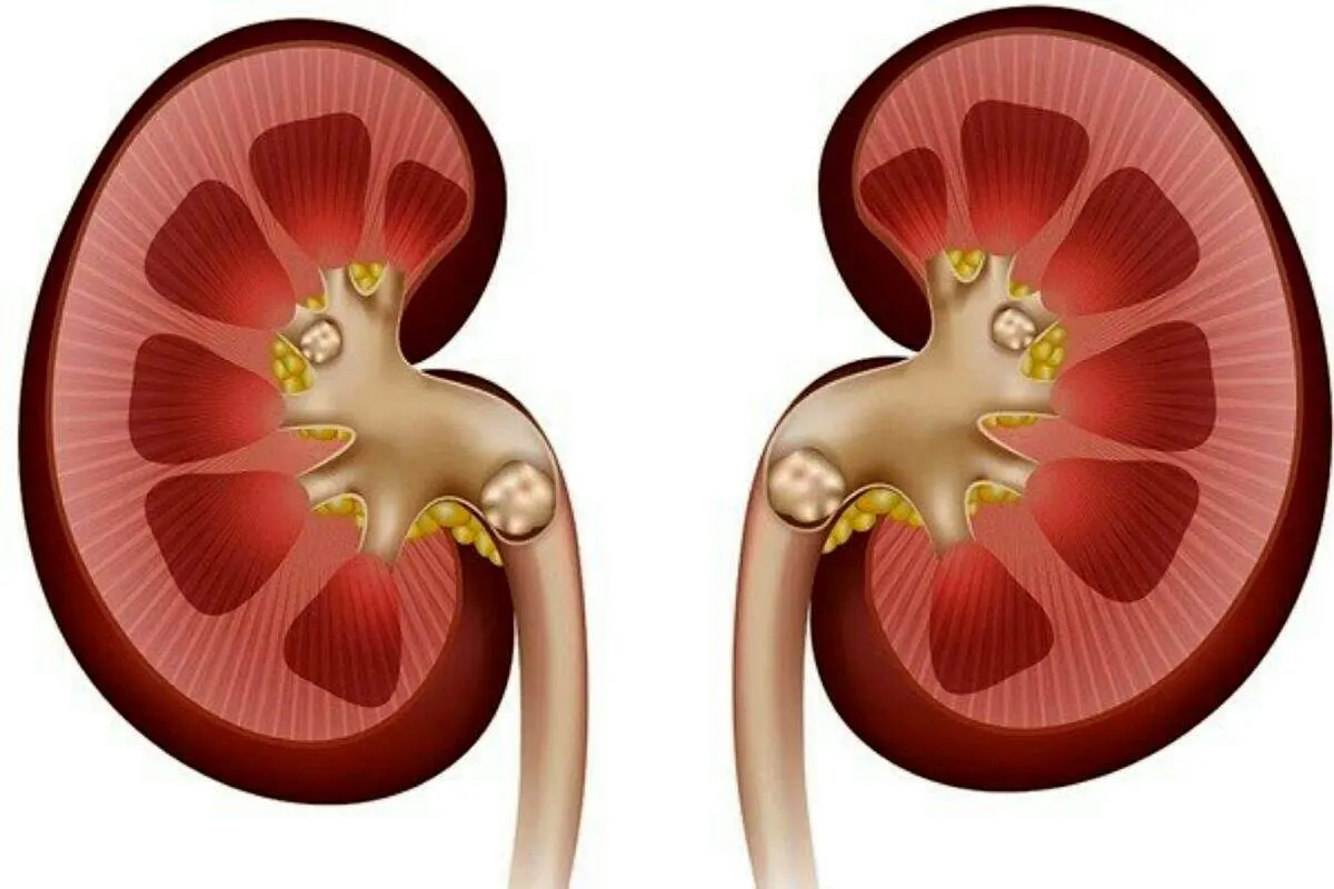  استرسِ ، کدام اندام حیاتی شما را نشانه رفته است؟