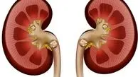  استرسِ ، کدام اندام حیاتی شما را نشانه رفته است؟