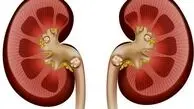  استرسِ ، کدام اندام حیاتی شما را نشانه رفته است؟