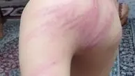 تنبیه به‌خاطر شارژر؛ خشم عمومی از ضرب‌وشتم دانش‌آموزان در سنندج