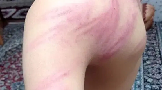 تنبیه به‌خاطر شارژر؛ خشم عمومی از ضرب‌وشتم دانش‌آموزان در سنندج