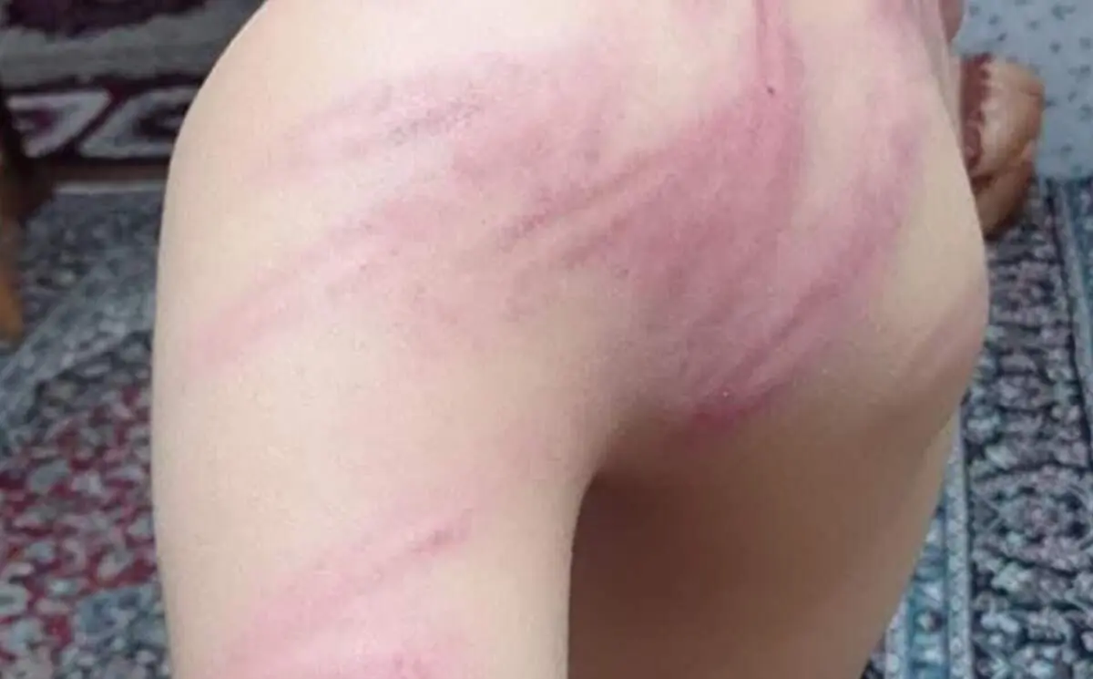 تنبیه به‌خاطر شارژر؛ خشم عمومی از ضرب‌وشتم دانش‌آموزان در سنندج