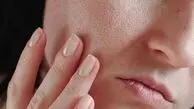نقش حیاتی ویتامین A در سلامت استخوان و پوست