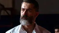 ماجرای عجیب شامپوی تقلبی و پیشانی ملتهب پارسا پیروزفر