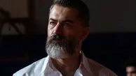 ماجرای عجیب شامپوی تقلبی و پیشانی ملتهب پارسا پیروزفر