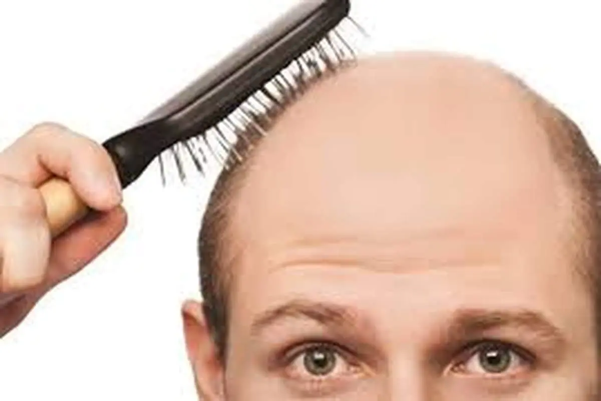 آیا شیفت کاری شبانه باعث ریزش مو می‌شود؟