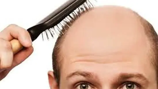 راز طلایی برای توقف ریزش مو و بازگرداندن رشد طبیعی