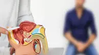 کلید پیشگیری و کنترل سرطان پروستات با این رژیم غذایی