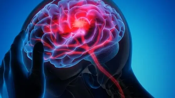  آیا تنها فشار کف پا می‌تواند سکته مغزی را قبل از بروز علائم، افشا کند؟ 