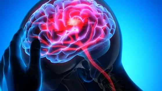  آیا تنها فشار کف پا می‌تواند سکته مغزی را قبل از بروز علائم، افشا کند؟ 