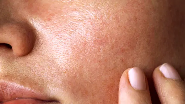 خوراکی‌هایی که پوست را جوان نگه می‌دارند