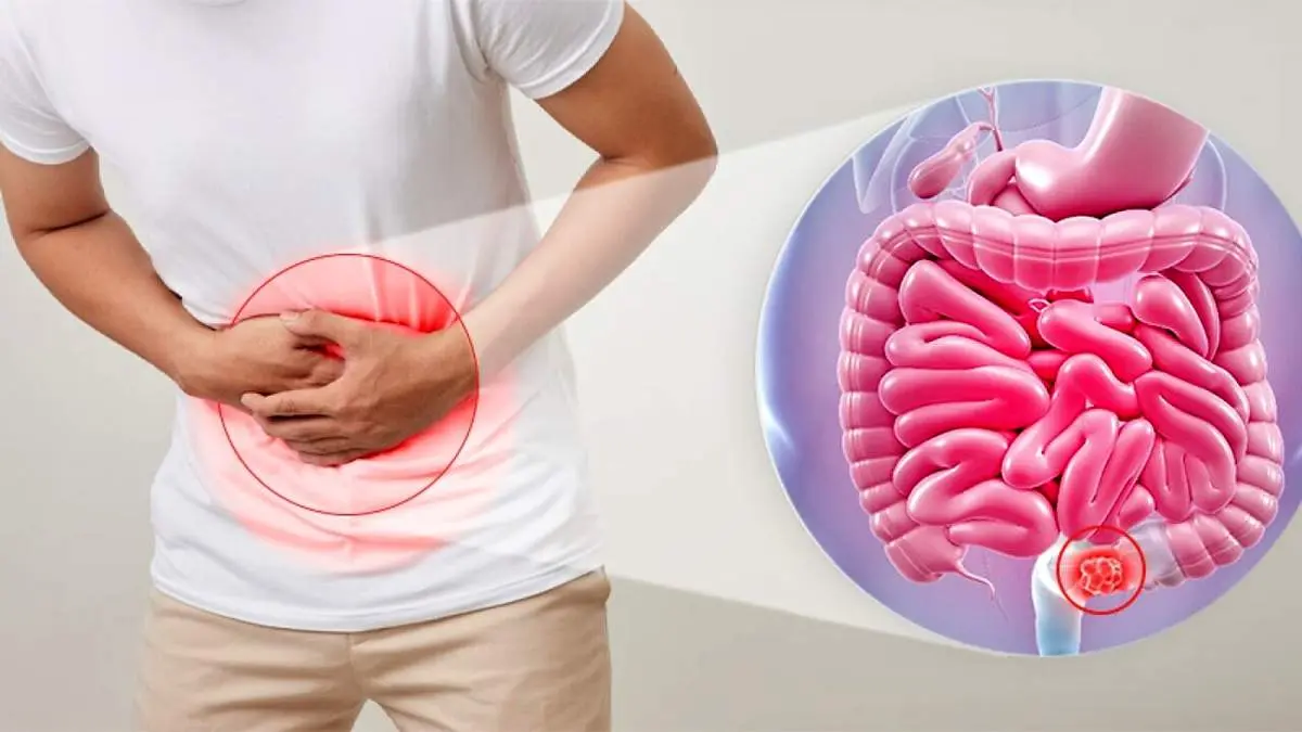 عادتهای مخرب روده که سلامت گوارش را تهدید میکنند