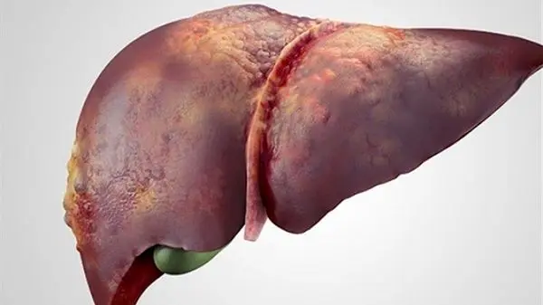 کدام عادت پنهان، سلامتی کبد را تهدید می‌کند؟